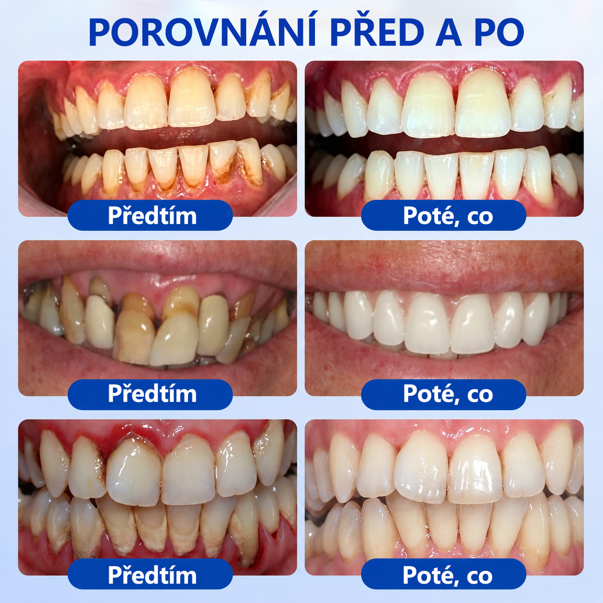 𝑬𝒗𝒐𝒍𝒗𝒊𝒐𝒏®👩‍⚕️ 𝑮𝒖𝒎𝑹𝒆𝒗𝒊𝒗𝒆 𝒈𝒆𝒍 𝒑𝒓𝒐 𝒑éč𝒊 𝒐 𝒅á𝒔𝒏ě 𝒂 𝒑𝒂𝒓𝒐𝒅𝒐𝒏𝒕🦷