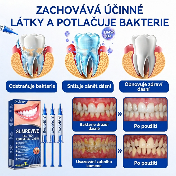 𝑬𝒗𝒐𝒍𝒗𝒊𝒐𝒏®👩‍⚕️ 𝑮𝒖𝒎𝑹𝒆𝒗𝒊𝒗𝒆 𝒈𝒆𝒍 𝒑𝒓𝒐 𝒑éč𝒊 𝒐 𝒅á𝒔𝒏ě 𝒂 𝒑𝒂𝒓𝒐𝒅𝒐𝒏𝒕🦷