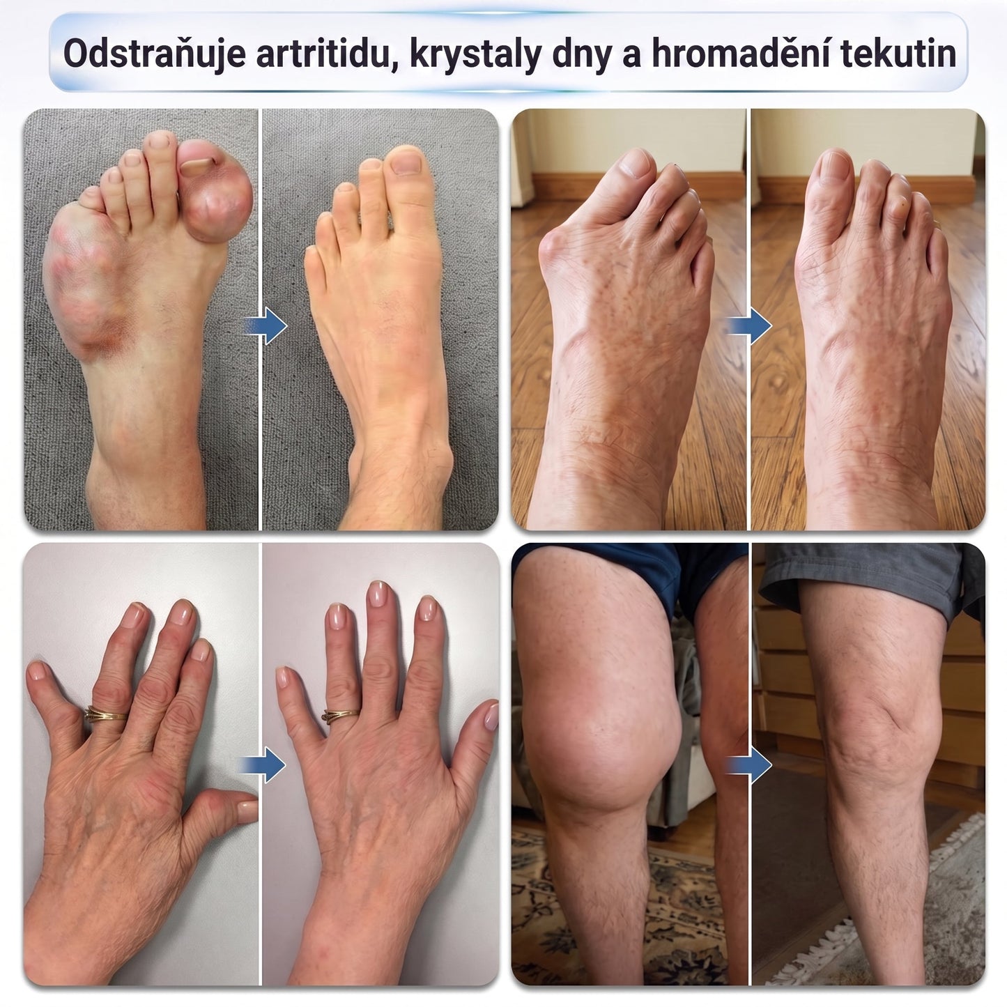 OFICIÁLNÍ OBCHOD | IFMAGIC® 0,05 mm Mikroneedle Rychle Působící Roll-On pro Úlevu Kloubů a Kostí🎆