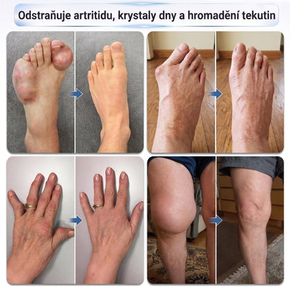 OFICIÁLNÍ OBCHOD | IFMAGIC® 0,05 mm Mikroneedle Rychle Působící Roll-On pro Úlevu Kloubů a Kostí🎆