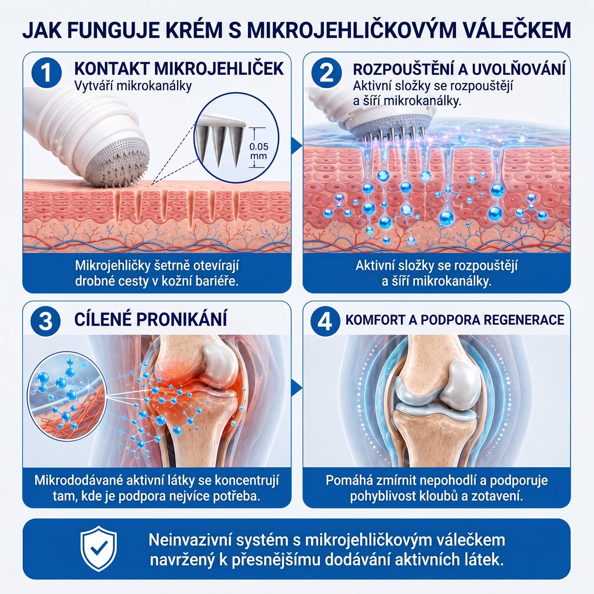OFICIÁLNÍ OBCHOD | IFMAGIC® 0,05 mm Mikroneedle Rychle Působící Roll-On pro Úlevu Kloubů a Kostí🎆