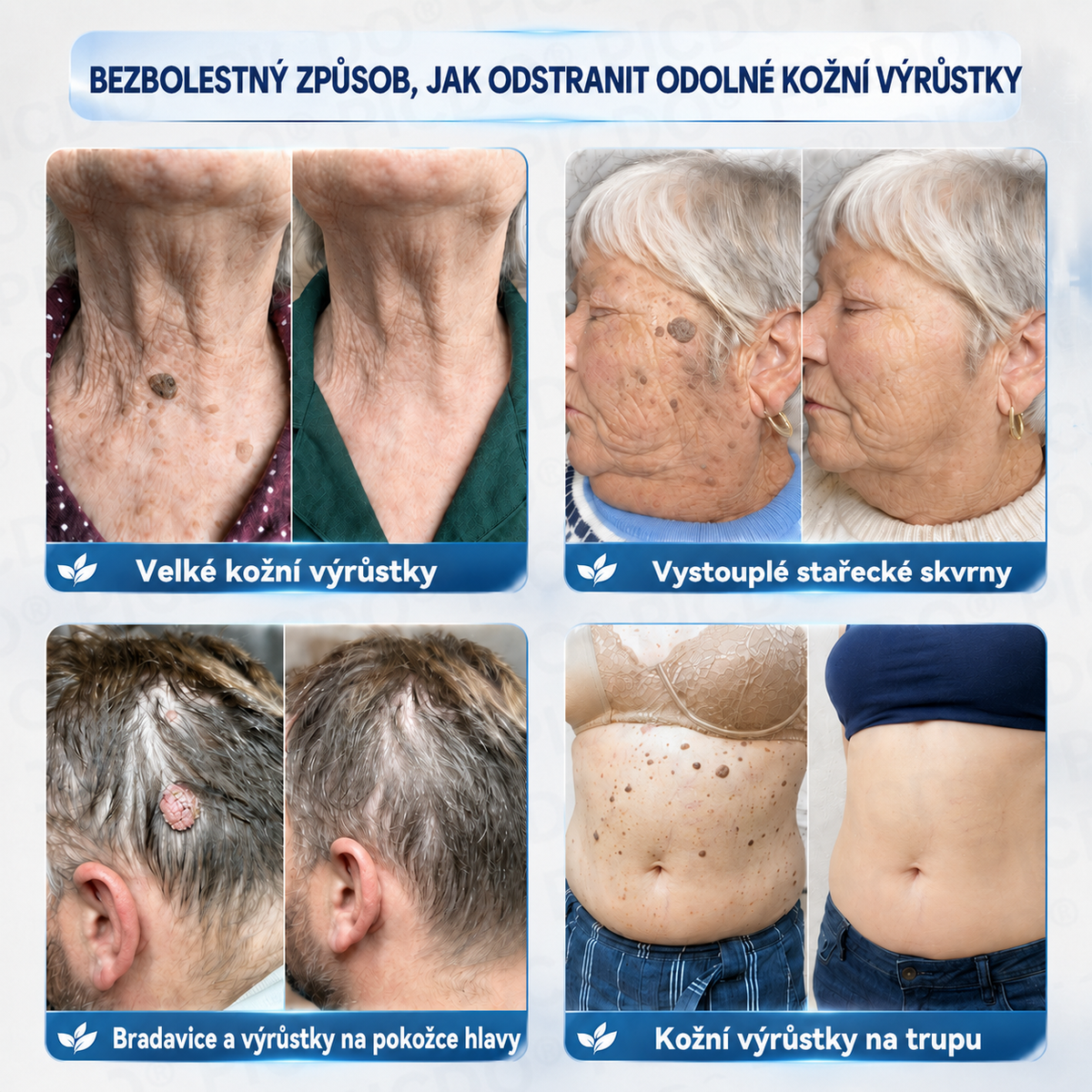 𝐏𝐢𝐜𝐝𝐨® 7𝒅𝒆𝒏𝒏í 𝒌𝒓é𝒎 𝒏𝒂 𝒐𝒅𝒔𝒕𝒓𝒂𝒏ě𝒏í 𝒌𝒐ž𝒏í𝒄𝒉 𝒗ý𝒓ů𝒔𝒕𝒌ů 𝒂 𝒔𝒌𝒗𝒓𝒏𝒚 ✅（Š𝒆𝒕𝒓𝒏á 𝒑𝒆č𝒖𝒋í𝒄í 𝒇𝒐𝒓𝒎𝒖𝒍𝒆, 𝒃𝒆𝒛 𝒗ý𝒓𝒂𝒛𝒏é𝒉𝒐 𝒑𝒐𝒄𝒊𝒕𝒖 𝒃𝒐𝒍𝒆𝒔𝒕𝒊, 𝒑𝒐𝒎á𝒉á 𝒓𝒆𝒅𝒖𝒌𝒐𝒗𝒂𝒕 𝒗𝒊𝒅𝒊𝒕𝒆𝒍𝒏𝒐𝒔𝒕 𝒏𝒆𝒅𝒐𝒌𝒐𝒏𝒂𝒍𝒐𝒔𝒕í）💎