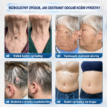 𝐏𝐢𝐜𝐝𝐨® 7𝒅𝒆𝒏𝒏í 𝒌𝒓é𝒎 𝒏𝒂 𝒐𝒅𝒔𝒕𝒓𝒂𝒏ě𝒏í 𝒌𝒐ž𝒏í𝒄𝒉 𝒗ý𝒓ů𝒔𝒕𝒌ů 𝒂 𝒔𝒌𝒗𝒓𝒏𝒚 ✅（Š𝒆𝒕𝒓𝒏á 𝒑𝒆č𝒖𝒋í𝒄í 𝒇𝒐𝒓𝒎𝒖𝒍𝒆, 𝒃𝒆𝒛 𝒗ý𝒓𝒂𝒛𝒏é𝒉𝒐 𝒑𝒐𝒄𝒊𝒕𝒖 𝒃𝒐𝒍𝒆𝒔𝒕𝒊, 𝒑𝒐𝒎á𝒉á 𝒓𝒆𝒅𝒖𝒌𝒐𝒗𝒂𝒕 𝒗𝒊𝒅𝒊𝒕𝒆𝒍𝒏𝒐𝒔𝒕 𝒏𝒆𝒅𝒐𝒌𝒐𝒏𝒂𝒍𝒐𝒔𝒕í）💎