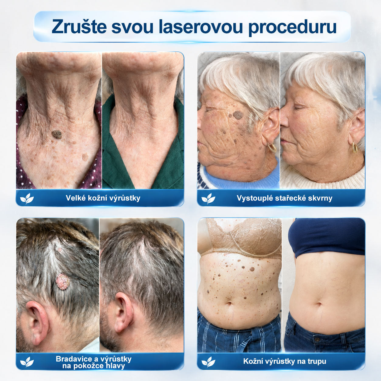 𝑶𝒇𝒊𝒄𝒊á𝒍𝒏í 𝒐𝒃𝒄𝒉𝒐𝒅 ✅ | 𝑃𝑖𝑐𝑑𝑜® 7𝒅𝒆𝒏𝒏í 𝒓𝒐𝒍𝒍-𝒐𝒏 𝒏𝒂 𝒐𝒅𝒔𝒕𝒓𝒂𝒏ě𝒏í 𝒌𝒐ž𝒏í𝒄𝒉 𝒔𝒌𝒗𝒓𝒏 𝒂 𝒌𝒐ž𝒏í𝒄𝒉 𝒗ý𝒓ů𝒔𝒕𝒌ů 👩‍⚕️(𝒃𝒆𝒛𝒃𝒐𝒍𝒆𝒔𝒕𝒏á 𝒂𝒑𝒍𝒊𝒌𝒂𝒄𝒆, 𝒑𝒐𝒉𝒐𝒅𝒍𝒏é 𝒑𝒐𝒖ž𝒊𝒕í)🔥