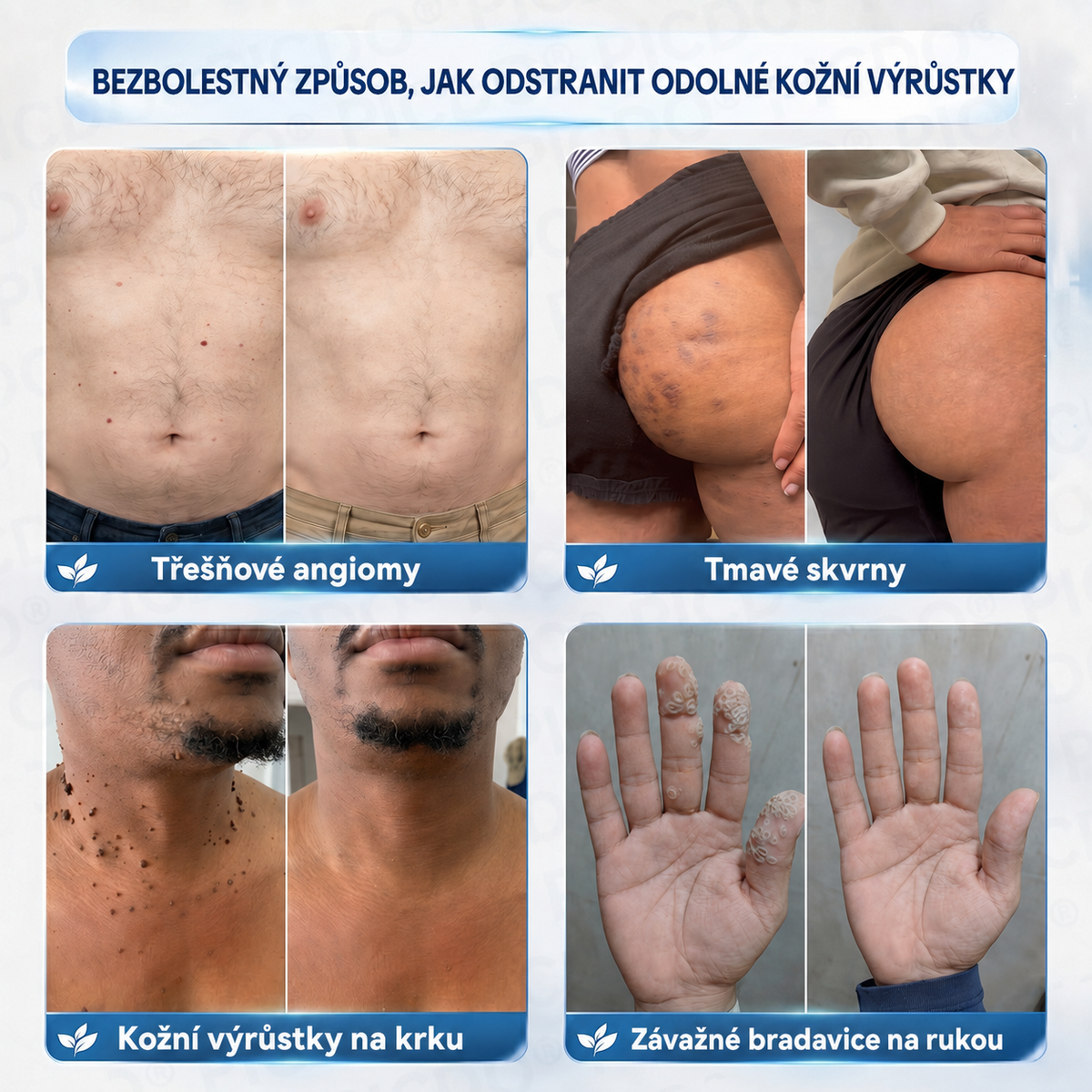 𝐏𝐢𝐜𝐝𝐨® 7𝒅𝒆𝒏𝒏í 𝒌𝒓é𝒎 𝒏𝒂 𝒐𝒅𝒔𝒕𝒓𝒂𝒏ě𝒏í 𝒌𝒐ž𝒏í𝒄𝒉 𝒗ý𝒓ů𝒔𝒕𝒌ů 𝒂 𝒔𝒌𝒗𝒓𝒏𝒚 ✅（Š𝒆𝒕𝒓𝒏á 𝒑𝒆č𝒖𝒋í𝒄í 𝒇𝒐𝒓𝒎𝒖𝒍𝒆, 𝒃𝒆𝒛 𝒗ý𝒓𝒂𝒛𝒏é𝒉𝒐 𝒑𝒐𝒄𝒊𝒕𝒖 𝒃𝒐𝒍𝒆𝒔𝒕𝒊, 𝒑𝒐𝒎á𝒉á 𝒓𝒆𝒅𝒖𝒌𝒐𝒗𝒂𝒕 𝒗𝒊𝒅𝒊𝒕𝒆𝒍𝒏𝒐𝒔𝒕 𝒏𝒆𝒅𝒐𝒌𝒐𝒏𝒂𝒍𝒐𝒔𝒕í）💎