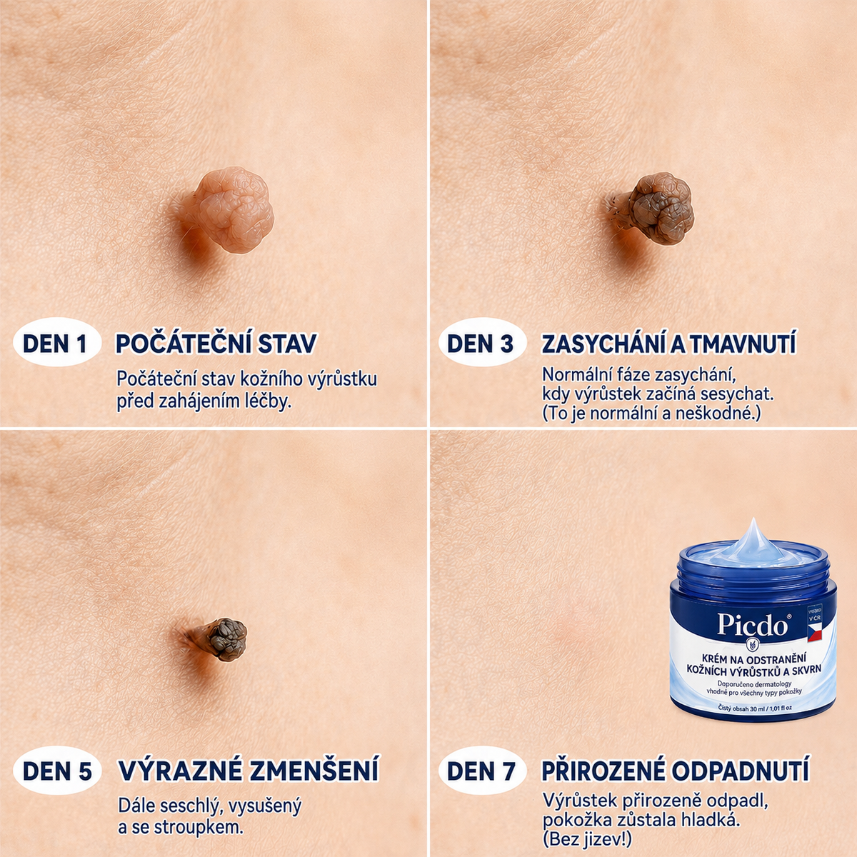 𝐏𝐢𝐜𝐝𝐨® 7𝒅𝒆𝒏𝒏í 𝒌𝒓é𝒎 𝒏𝒂 𝒐𝒅𝒔𝒕𝒓𝒂𝒏ě𝒏í 𝒌𝒐ž𝒏í𝒄𝒉 𝒗ý𝒓ů𝒔𝒕𝒌ů 𝒂 𝒔𝒌𝒗𝒓𝒏𝒚 ✅（Š𝒆𝒕𝒓𝒏á 𝒑𝒆č𝒖𝒋í𝒄í 𝒇𝒐𝒓𝒎𝒖𝒍𝒆, 𝒃𝒆𝒛 𝒗ý𝒓𝒂𝒛𝒏é𝒉𝒐 𝒑𝒐𝒄𝒊𝒕𝒖 𝒃𝒐𝒍𝒆𝒔𝒕𝒊, 𝒑𝒐𝒎á𝒉á 𝒓𝒆𝒅𝒖𝒌𝒐𝒗𝒂𝒕 𝒗𝒊𝒅𝒊𝒕𝒆𝒍𝒏𝒐𝒔𝒕 𝒏𝒆𝒅𝒐𝒌𝒐𝒏𝒂𝒍𝒐𝒔𝒕í）💎