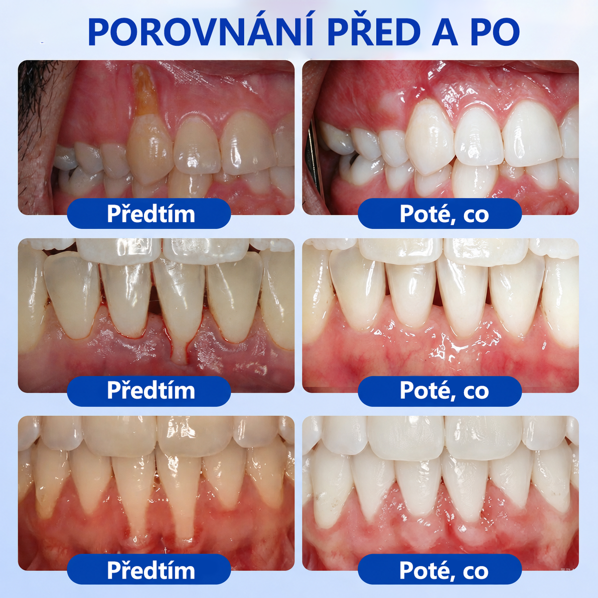 𝑬𝒗𝒐𝒍𝒗𝒊𝒐𝒏®👩‍⚕️ 𝑮𝒖𝒎𝑹𝒆𝒗𝒊𝒗𝒆 𝒈𝒆𝒍 𝒑𝒓𝒐 𝒑éč𝒊 𝒐 𝒅á𝒔𝒏ě 𝒂 𝒑𝒂𝒓𝒐𝒅𝒐𝒏𝒕🦷