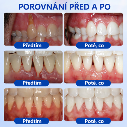 𝑬𝒗𝒐𝒍𝒗𝒊𝒐𝒏®👩‍⚕️ 𝑮𝒖𝒎𝑹𝒆𝒗𝒊𝒗𝒆 𝒈𝒆𝒍 𝒑𝒓𝒐 𝒑éč𝒊 𝒐 𝒅á𝒔𝒏ě 𝒂 𝒑𝒂𝒓𝒐𝒅𝒐𝒏𝒕🦷
